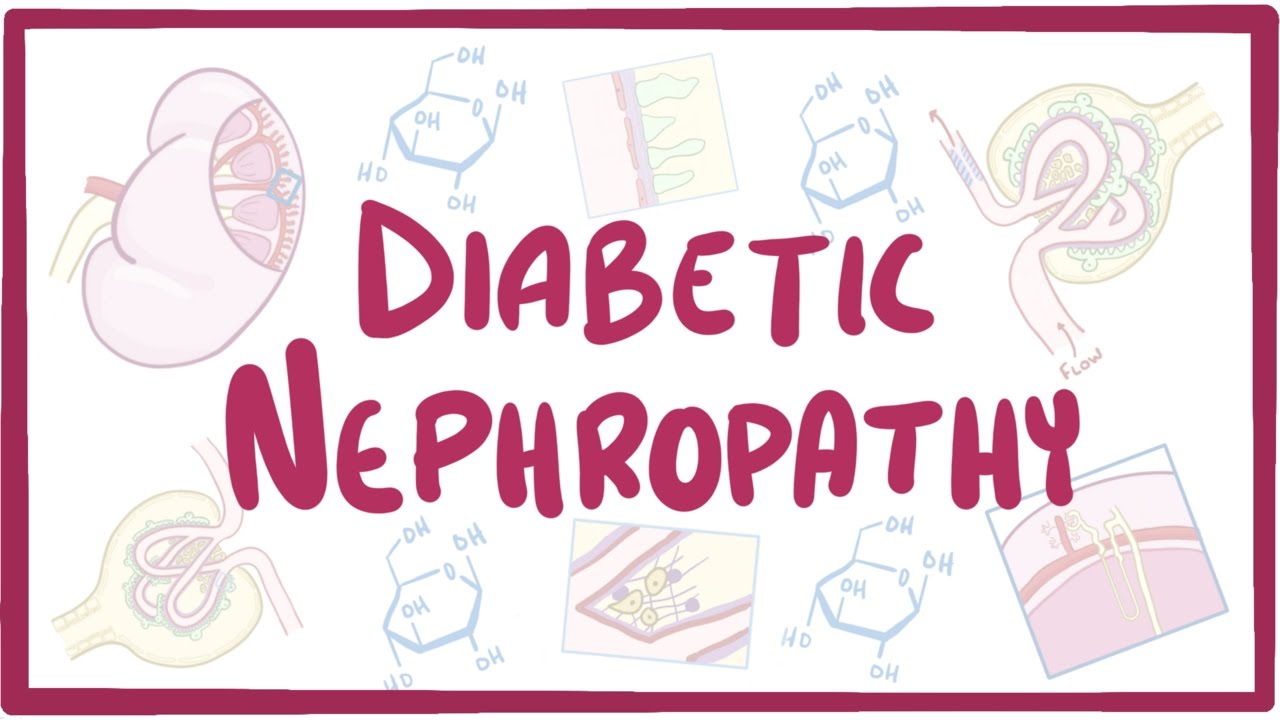Diabetic Nephropathy Photo